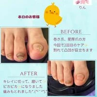 画像1348：ビフォーアフター
