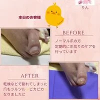画像1349：ビフォーアフター
