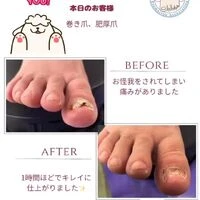 画像1350：ビフォーアフター