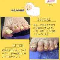 画像1383：ビフォーアフター