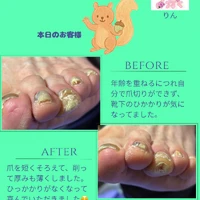 画像1462：ビフォーアフター
