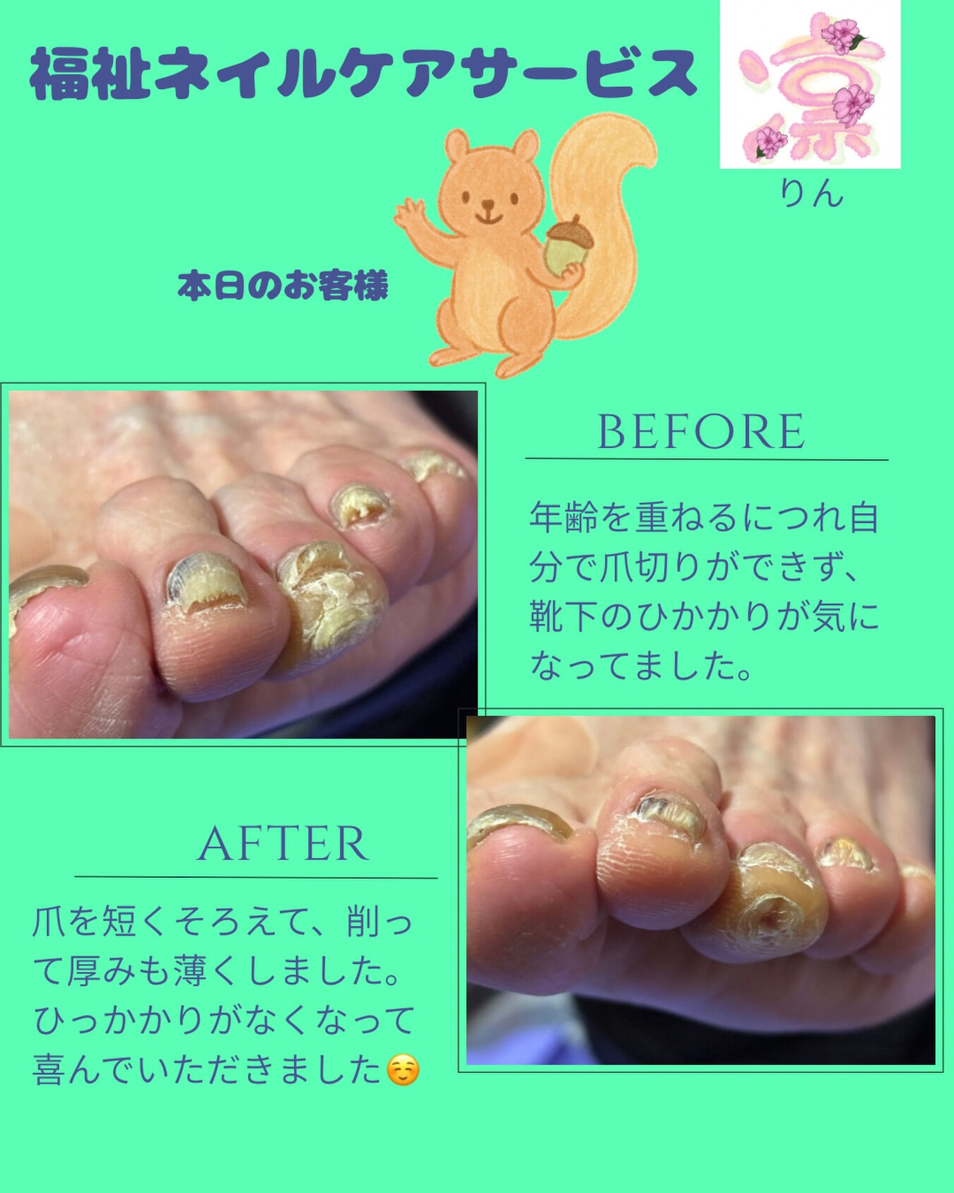 高齢になってくると、自分で爪切りをするのが難しくなることがあ