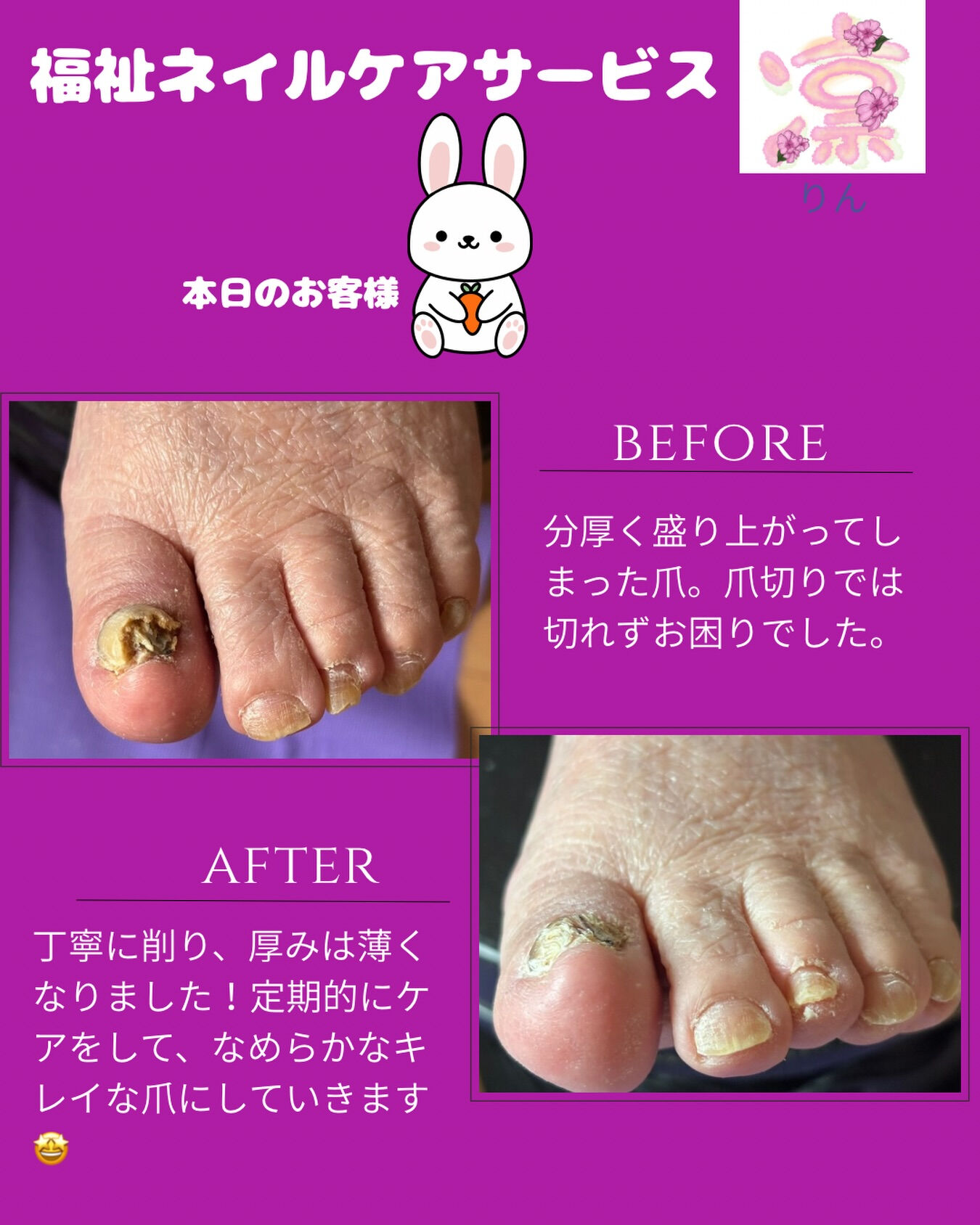 毎日の生活で見過ごされがちな爪のケアですが、実はとても重要で