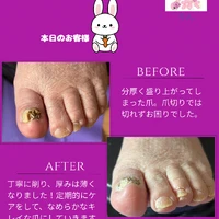 画像1823：ビフォーアフター